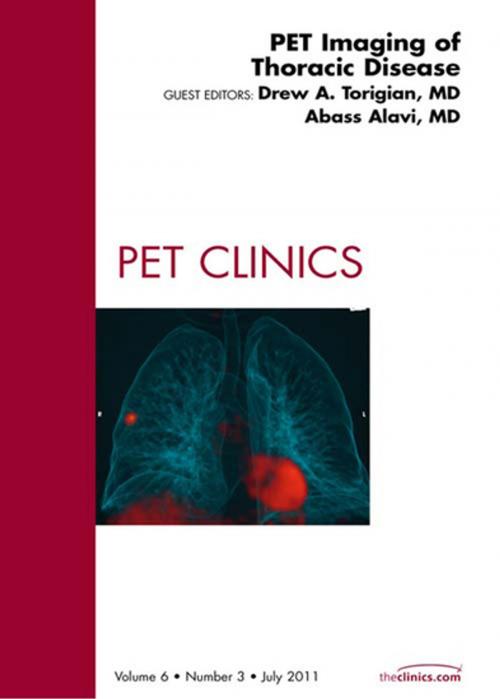 Cover of the book PET Imaging of Thoracic Disease, An Issue of PET Clinics - E-Book by Drew A. Torigian, MD, MA, Abass Alavi, MD, Elsevier Health Sciences