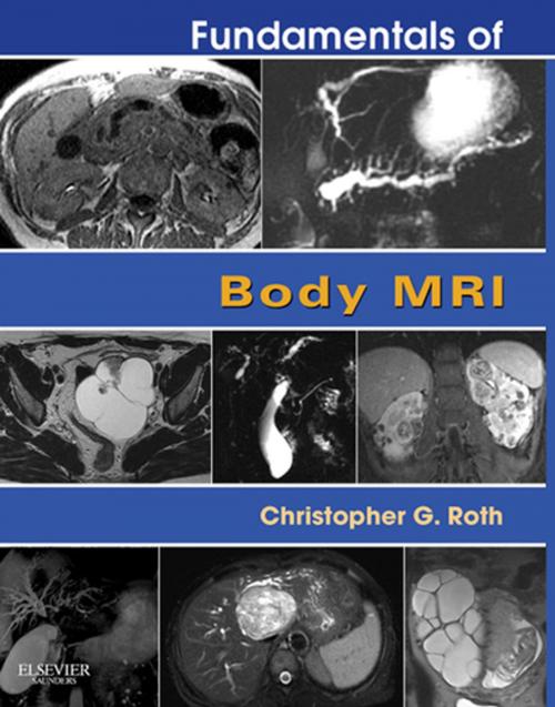 Cover of the book Fundamentals of Body MRI E-Book by Christopher G. Roth, MD, Elsevier Health Sciences