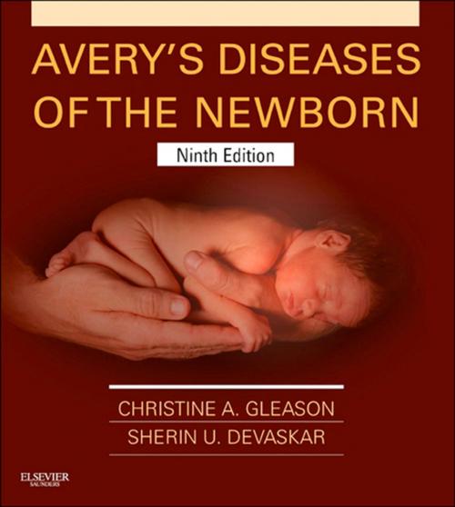 Cover of the book Avery's Diseases of the Newborn E-Book by Christine A. Gleason, MD, Sherin Devaskar, MD, Elsevier Health Sciences