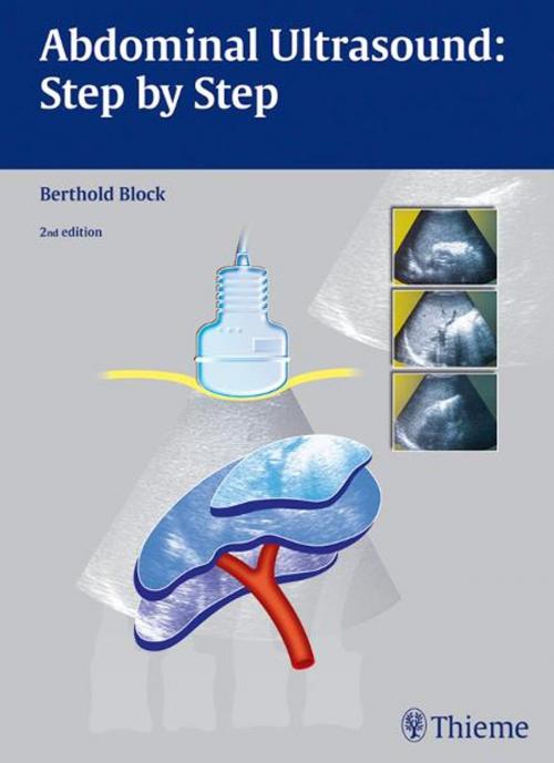 Cover of the book Abdominal Ultrasound: Step by Step by Berthold Block, Thieme