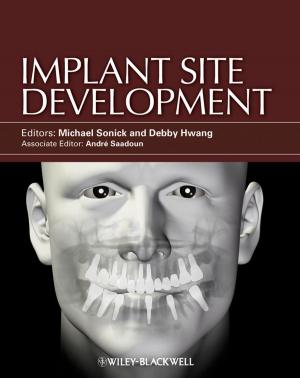 Cover of the book Implant Site Development by Alexander Osterwalder, Gregory Bernarda, Alan Smith, Trish Papadakos, Yves Pigneur