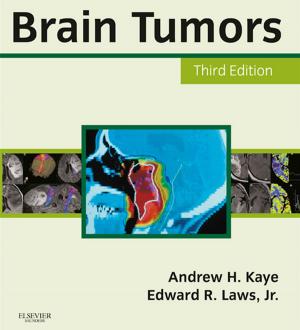 Book cover of Brain Tumors E-Book