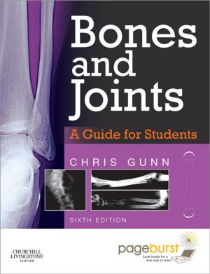 Book cover of Bones and Joints - E-book