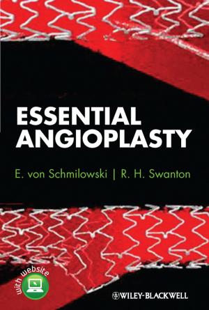 Cover of the book Essential Angioplasty by Arthur E. Jongsma Jr., L. Mark Peterson, William P. McInnis, David J. Berghuis