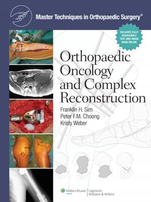 Cover of the book Master Techniques in Orthopaedic Surgery: Orthopaedic Oncology and Complex Reconstruction by Jean F. Simpson, Melinda E. Sanders