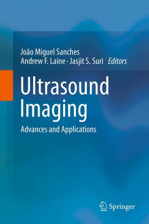 Cover of the book Ultrasound Imaging by Alexander Schmitt, Wolfgang Minker