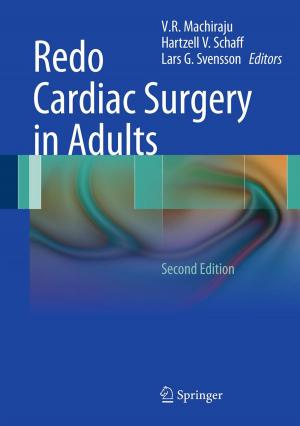 Cover of the book Redo Cardiac Surgery in Adults by Feng Dai, Yuan Xu