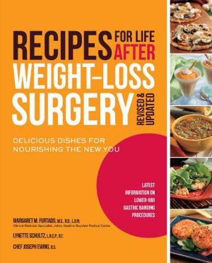 Cover of the book Recipes for Life After Weight-Loss Surgery, Revised and Updated: Delicious Dishes for Nourishing the New You and the Latest Information on Lower-BMI Gastric Banding Procedures by Deirdre Rawlings, Ph.D., N.D.