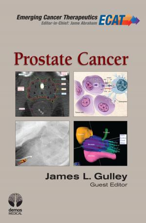 Cover of the book Prostate Cancer by Amelia Davis