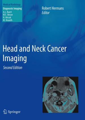 Cover of the book Head and Neck Cancer Imaging by Robert M. Pigache