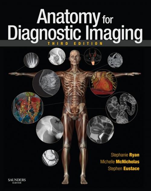 Cover of the book Anatomy for Diagnostic Imaging E-Book by Stephanie Ryan, FRCSI FFR(RCSI), Michelle McNicholas, MRCPI FFR(RCSI) FRCR, Stephen J Eustace, MB MSc(RadSci) MRCPI FFR(RCSI) FRCR FFSEM, Elsevier Health Sciences