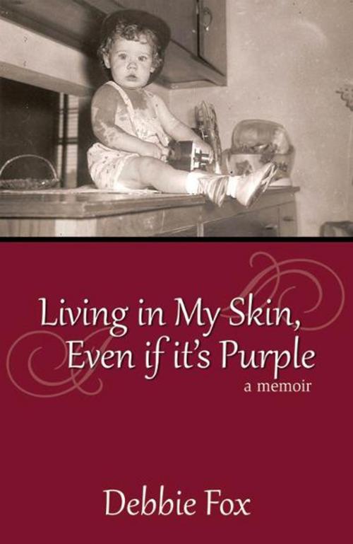 Cover of the book Living In My Skin, Even If It's Purple by Debbie Fox, Infinity Publishing
