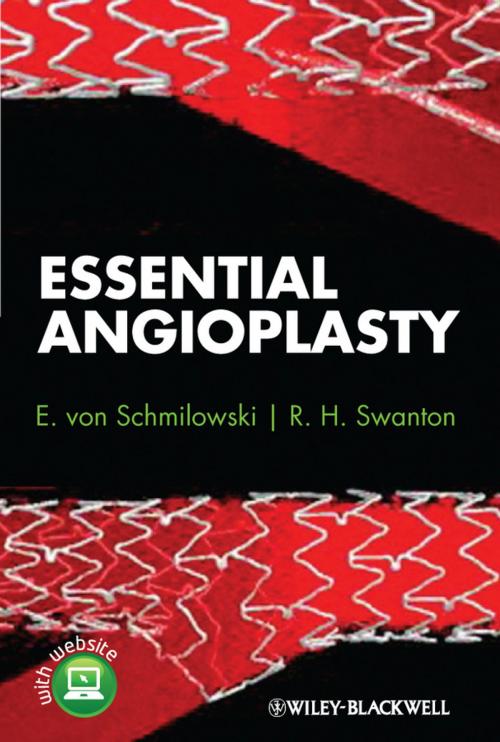 Cover of the book Essential Angioplasty by E. von Schmilowski, R. H. Swanton, Wiley