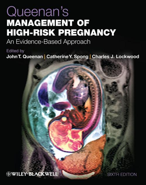 Cover of the book Queenan's Management of High-Risk Pregnancy by , Wiley