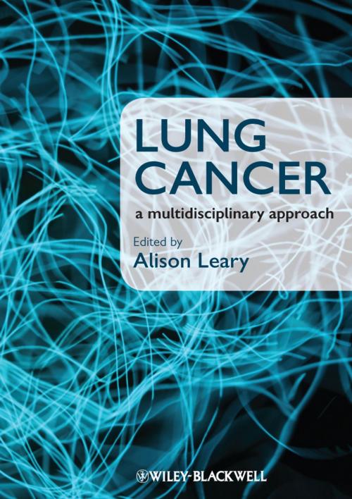 Cover of the book Lung Cancer by , Wiley