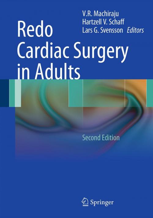 Cover of the book Redo Cardiac Surgery in Adults by , Springer New York