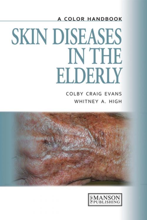 Cover of the book Skin Diseases in the Elderly by Colby Evans, Whitney High, CRC Press