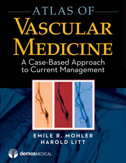 Cover of the book Atlas of Vascular Medicine by , Springer Publishing Company