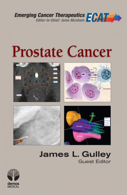 Cover of the book Prostate Cancer by James L. Gulley, MD, PhD, FACP, Jame Abraham, MD, FACP, Springer Publishing Company