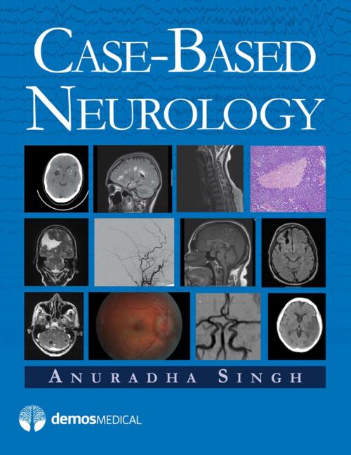 Cover of the book Case-Based Neurology by Anuradha Singh, MD, Springer Publishing Company