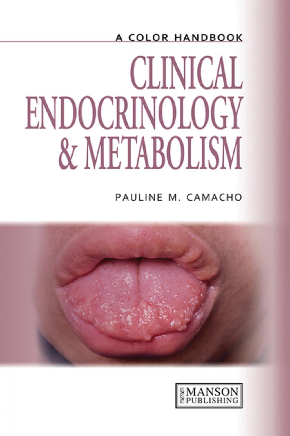 Big bigCover of Clinical Endocrinology and Metabolism