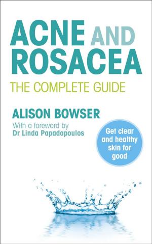 bigCover of the book Acne and Rosacea by 