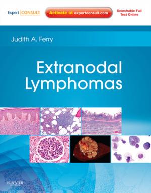 Cover of the book Extranodal Lymphomas E-Book by Joel A. Kaplan, MD