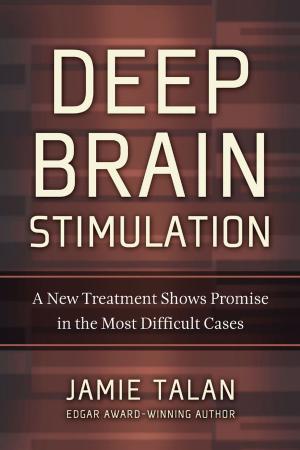 Cover of Deep Brain Stimulation