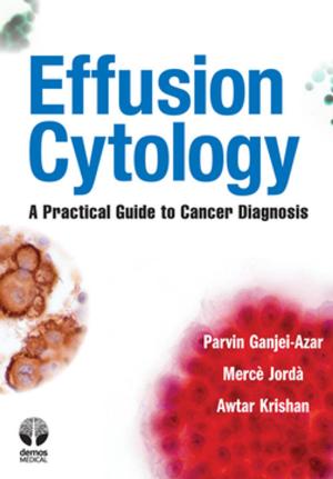 Cover of the book Effusion Cytology by Joseph M. Tonkonogy, Antonio E. Puente
