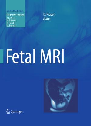 Cover of the book Fetal MRI by J. Bromley, Karl R. Müller, J.T. Farquhar, P.T. Gidley, S. James, D. Martinetz, A. Robin, N.B. Schomaker, R.D. Stephens, D.B. Walters