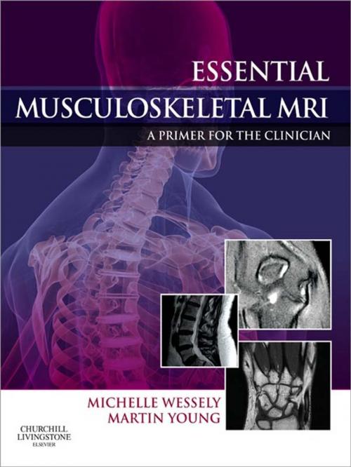 Cover of the book Essential Musculoskeletal MRI by Michelle Anna Wessely, Martin Ferrier Young, Elsevier Health Sciences UK