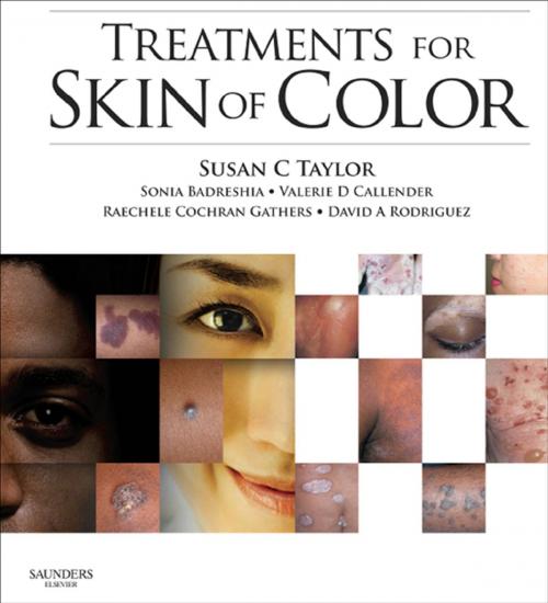 Cover of the book Treatments for Skin of Color E-Book by Susan C. Taylor, MD, Raechele C. Gathers, MD, Valerie D. Callender, MD, David A. Rodriguez, MD, Sonia Badreshia-Bansal, MD, Elsevier Health Sciences