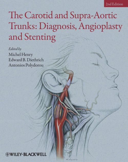 Cover of the book The Carotid and Supra-Aortic Trunks by Michel Henry, Edward B. Diethrich, Antonios Polydorou, Wiley