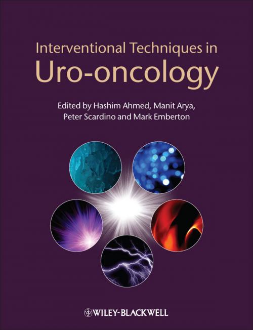Cover of the book Interventional Techniques in Uro-oncology by , Wiley