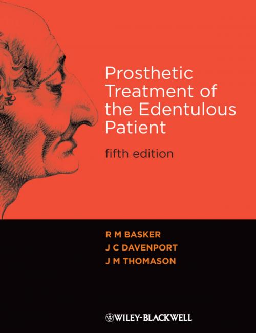 Cover of the book Prosthetic Treatment of the Edentulous Patient by R. M. Basker, J. C. Davenport, J. M. Thomason, Wiley