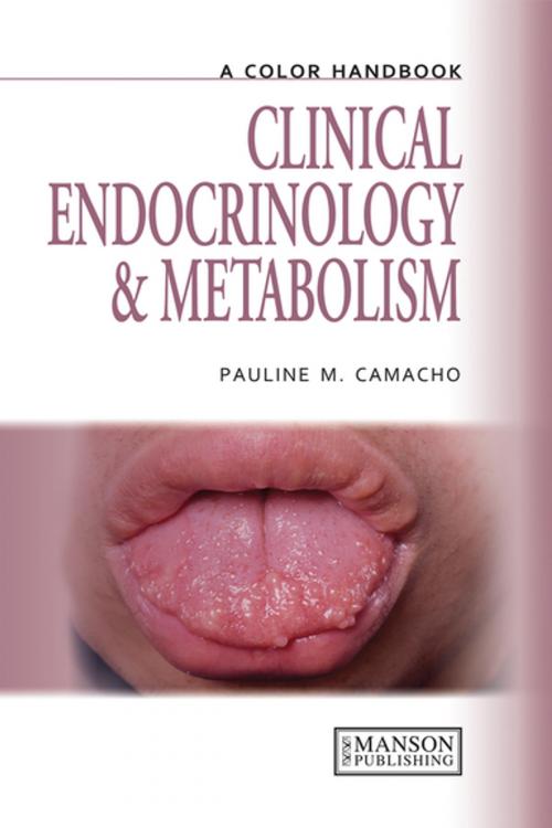 Cover of the book Clinical Endocrinology and Metabolism by Pauline Camacho, CRC Press