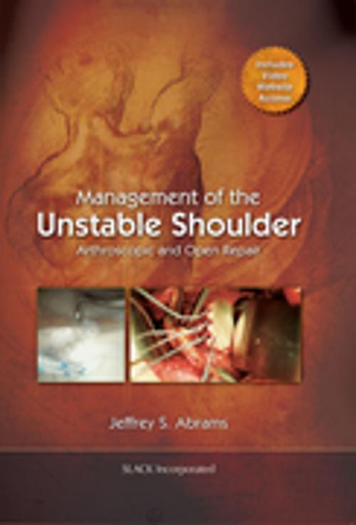 Cover of the book Management of the Unstable Shoulder by , SLACK Incorporated