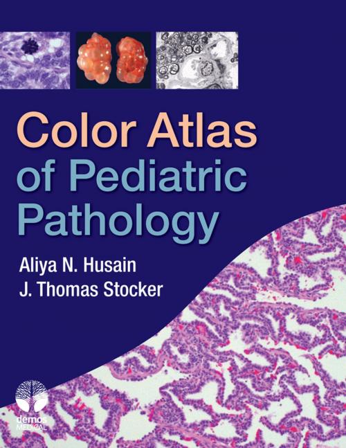 Cover of the book Color Atlas of Pediatric Pathology by , Springer Publishing Company