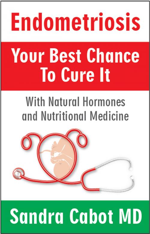 Cover of the book Endometriosis your best chance to cure it by Sandra Cabot MD, SCB International Inc.