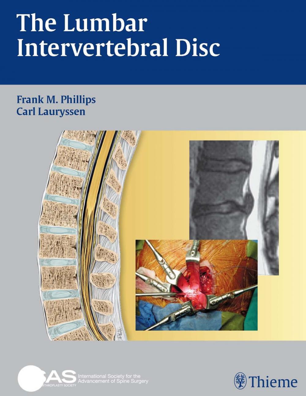 Big bigCover of Lumbar Intervertebral Disc