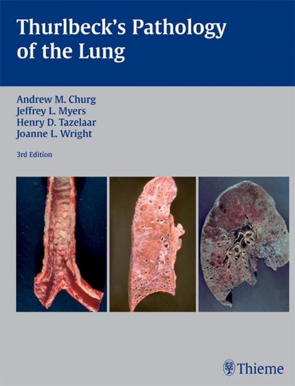 Big bigCover of Thurlbeck's Pathology of the Lung