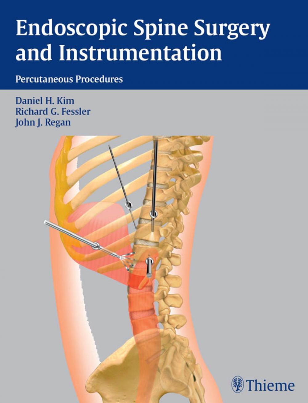 Big bigCover of Endoscopic Spine Surgery and Instrumentation