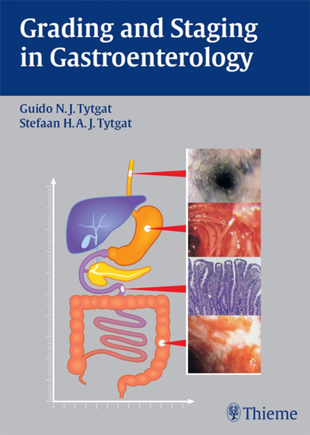 Big bigCover of Grading and Staging in Gastroenterology