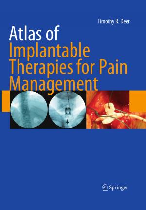 Cover of the book Atlas of Implantable Therapies for Pain Management by Lawrence E. Larson, Prasad S. Gudem, Mohammad Farazian