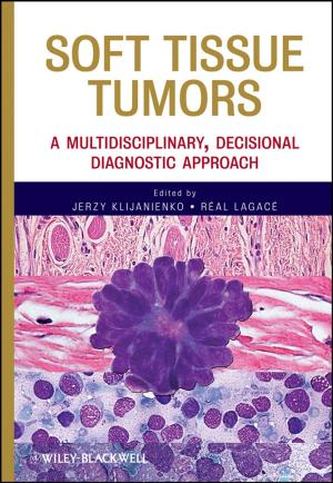 Cover of the book Soft Tissue Tumors by Sarah Wolfensohn, Maggie Lloyd