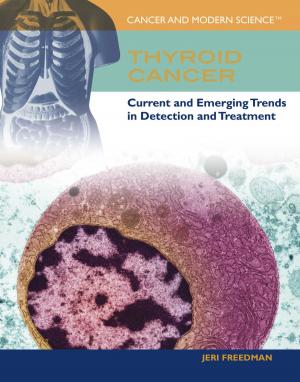 Cover of the book Thyroid Cancer by Christopher Harris