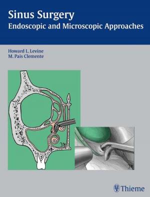 Cover of the book Sinus Surgery by 