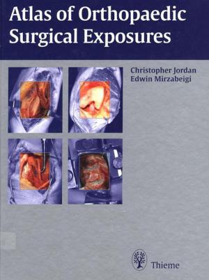 Book cover of Atlas of Orthopaedic Surgical Exposures