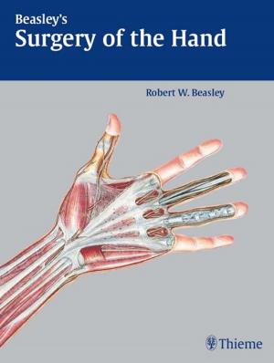Cover of the book Beasley's Surgery of the Hand by Val M. Runge, Wolgang R. Nitz, Johannes T. Heverhagen