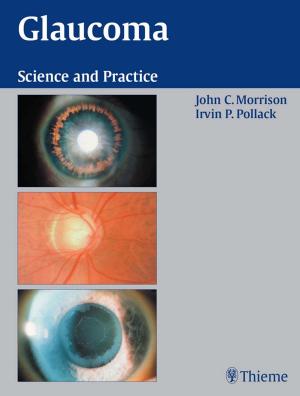 Book cover of Glaucoma